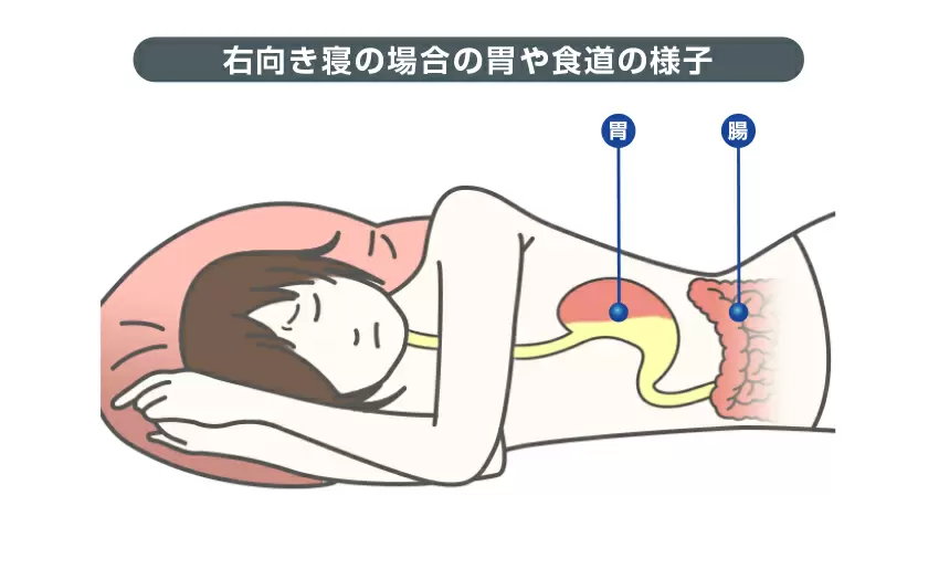 右向き寝の場合の胃や食道の様子
