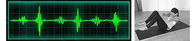 一般的な腹筋運動