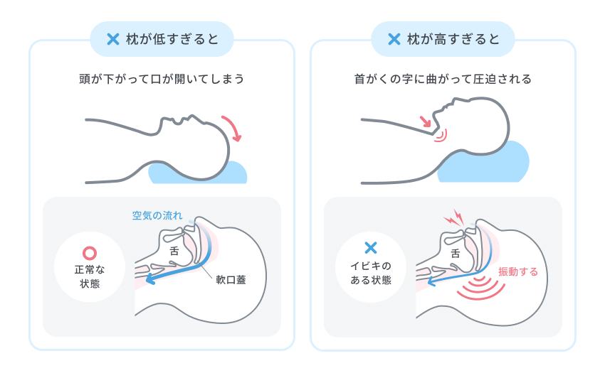 気道が圧迫されていびきが悪化する