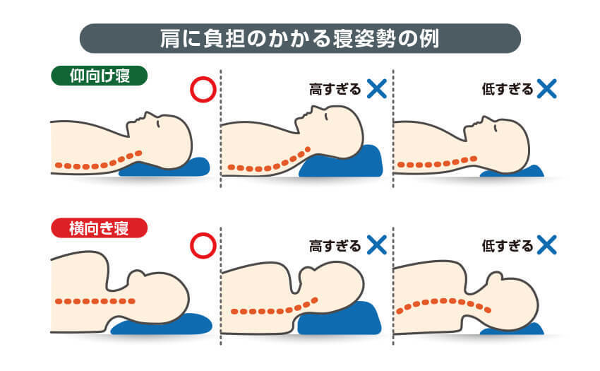 肩に負担のかかる寝姿勢の例