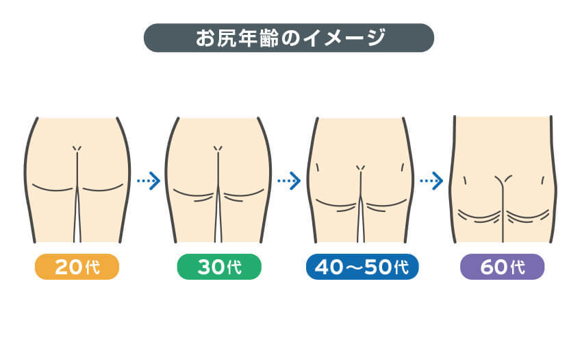 お尻年齢のイメージ