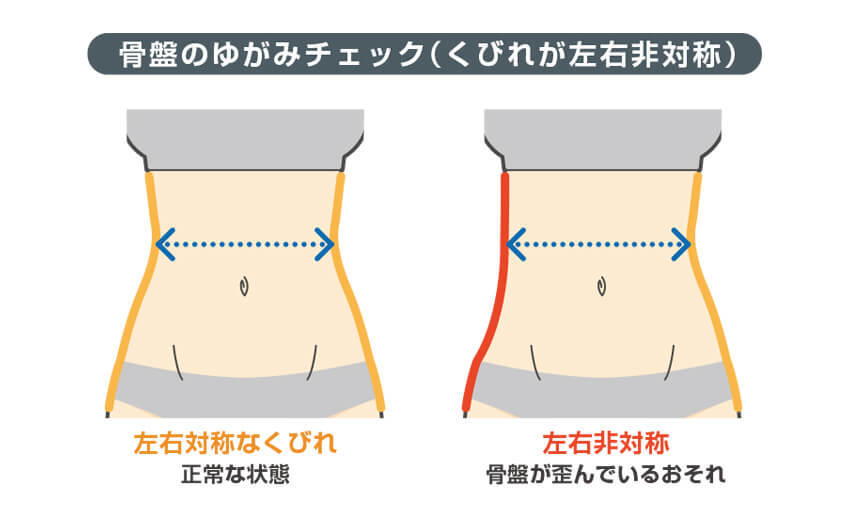 骨盤のゆがみチェック(くびれが左右非対称)