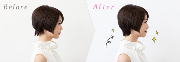 Before After