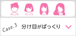 Case.3 分け目がぱっくり