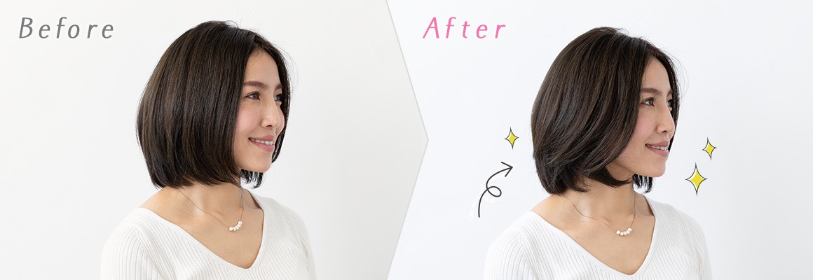 Before After