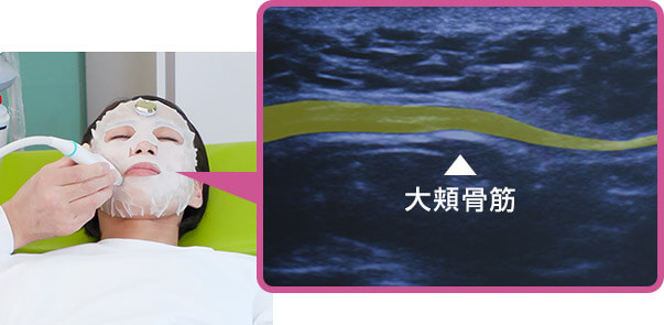 大頬骨筋