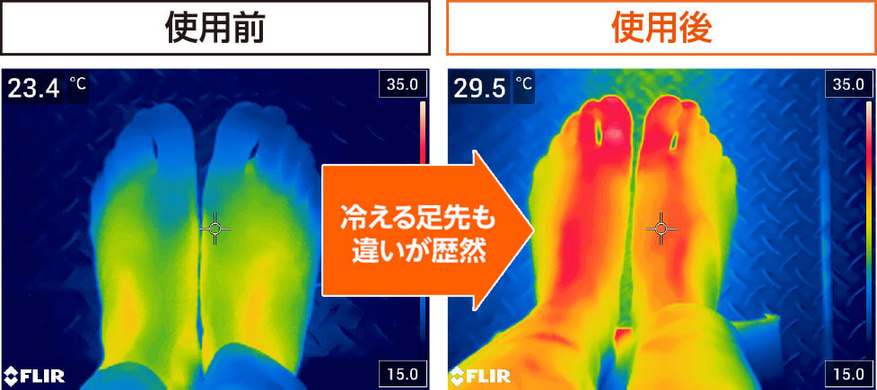 使用前 23.4℃ 使用後 29.5℃ 冷える足先も違いが歴然