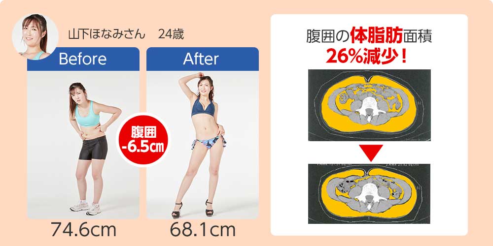 山下ほなみさん 24歳 腹囲の体脂肪面積26%減少!