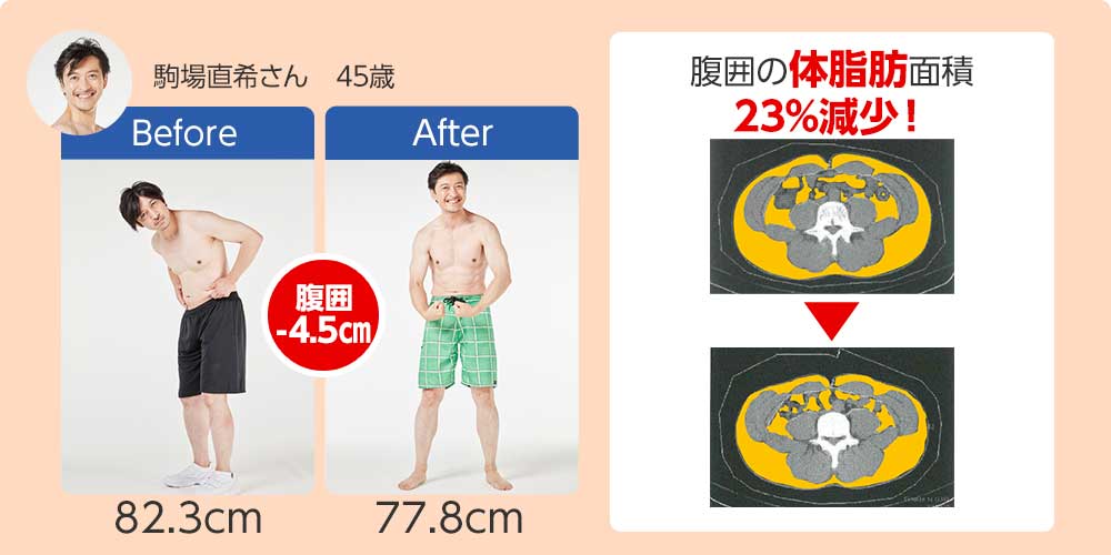 駒場直希さん 45歳 腹囲の体脂肪面積23%減少!