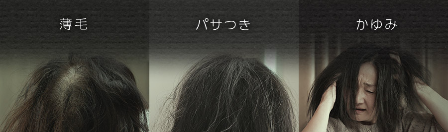 薄毛 パサつき かゆみ