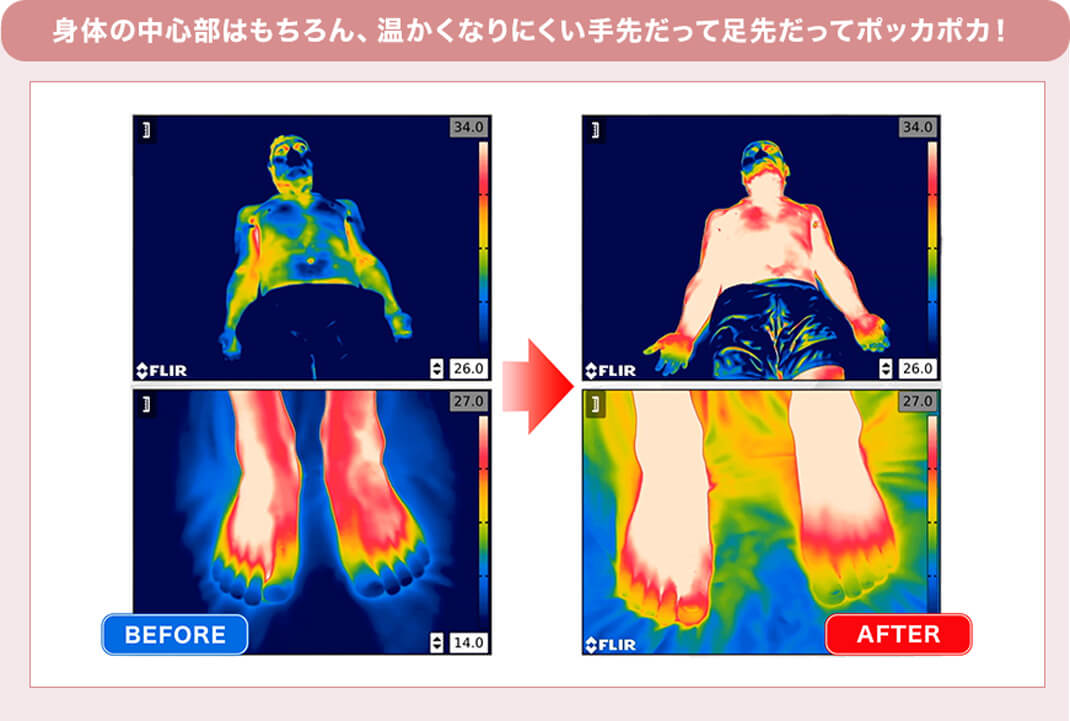 身体の中心部はもちろん、温かくなりにくい手先だって足先だってポッカポカ! BEFORE → AFTER