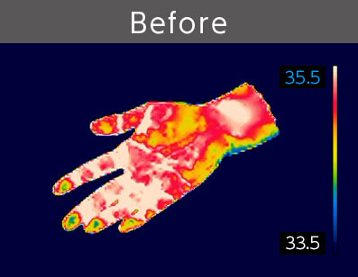 Brfore 35.5 33.5